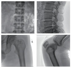 ENDO C-ARM2